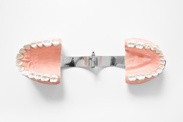 Multiple Tooth Implants